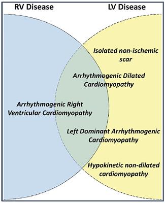 Frontiers | Arrhythmogenic Right Ventricular Cardiomyopathy In ...